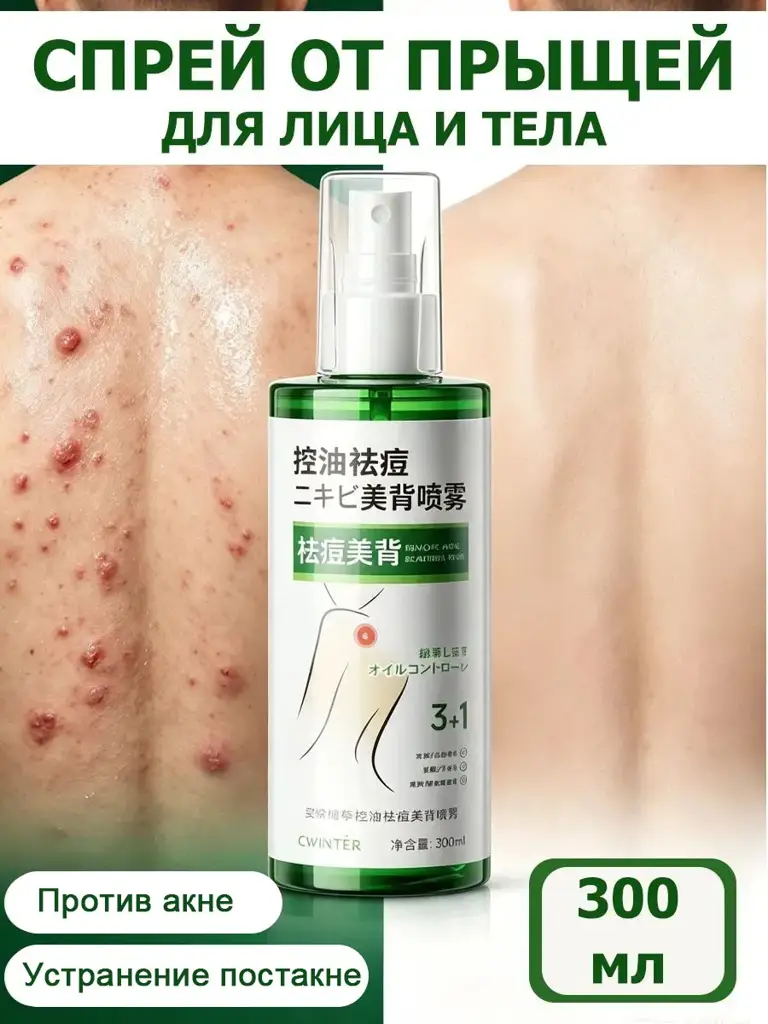 Acne Care Spray for Face and Body, 300 ml #1