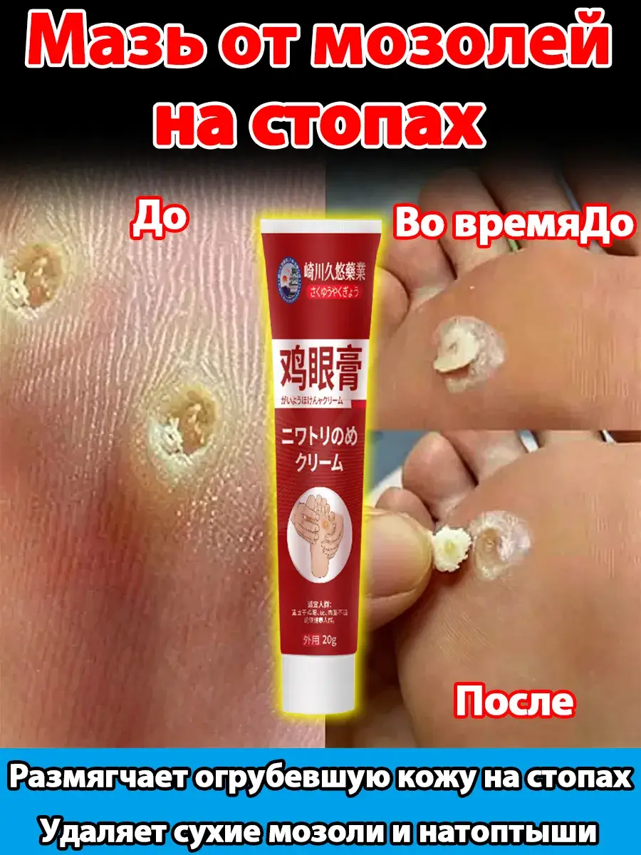 Foot Corn and Callus Ointment for Skin Care