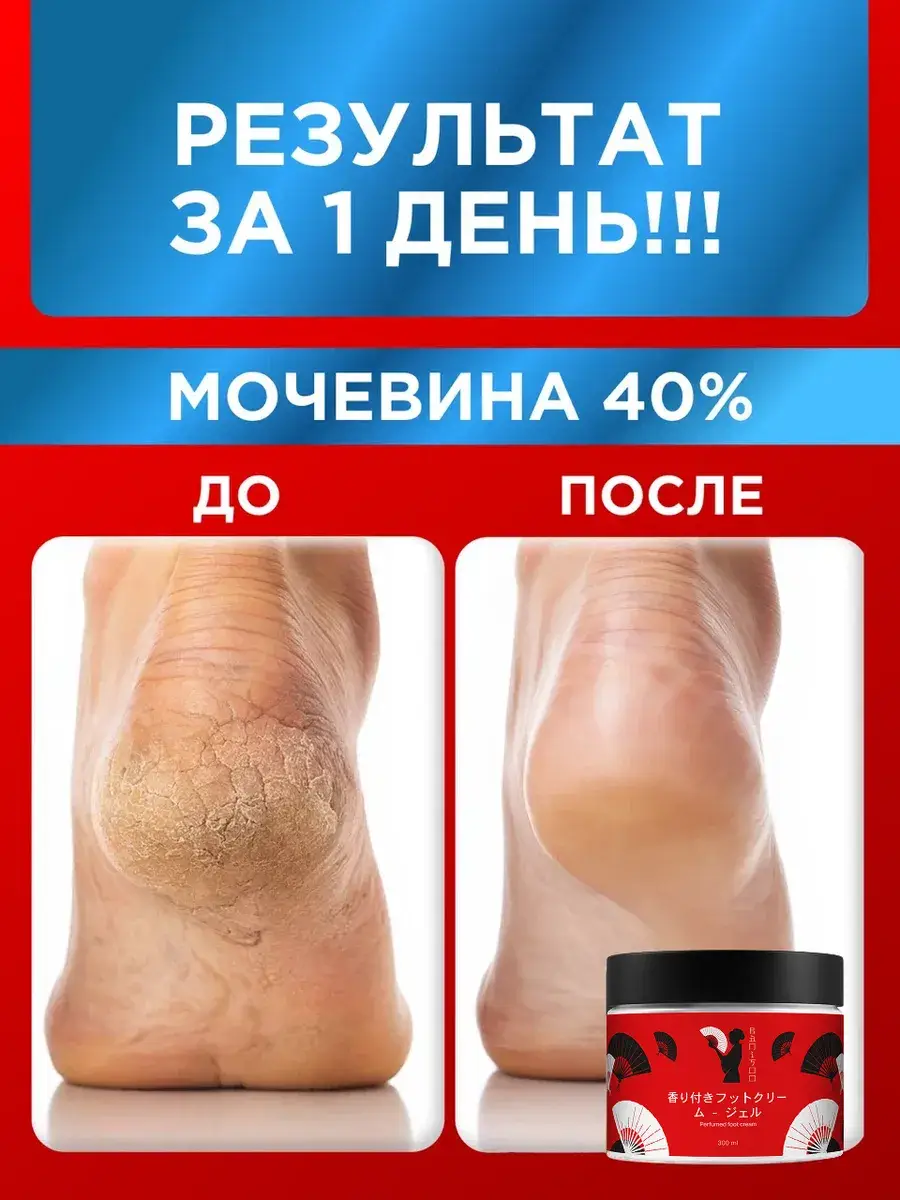 Banisoo Foot Cream with Urea 40% 300 ml