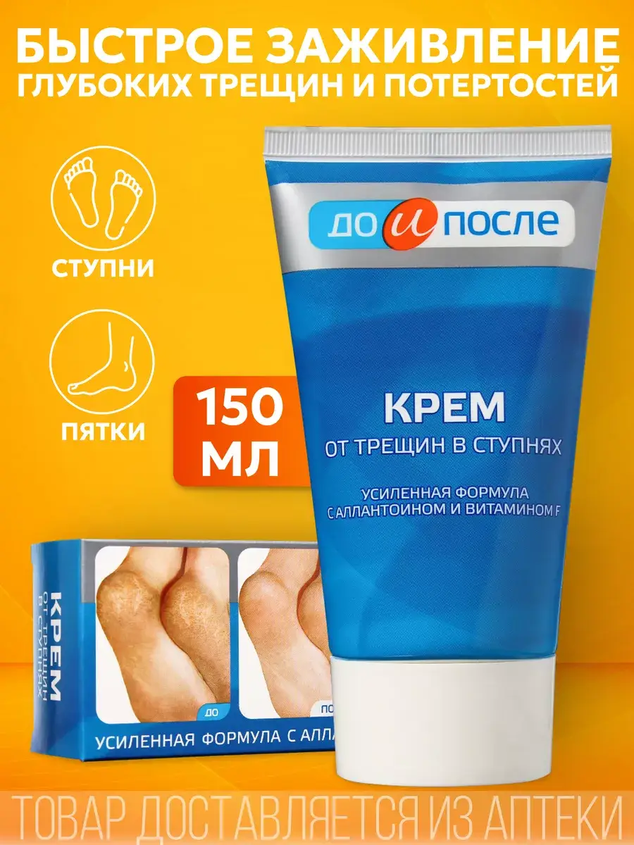 Twins Tec Foot Cream for Cracked Heels 150 ml