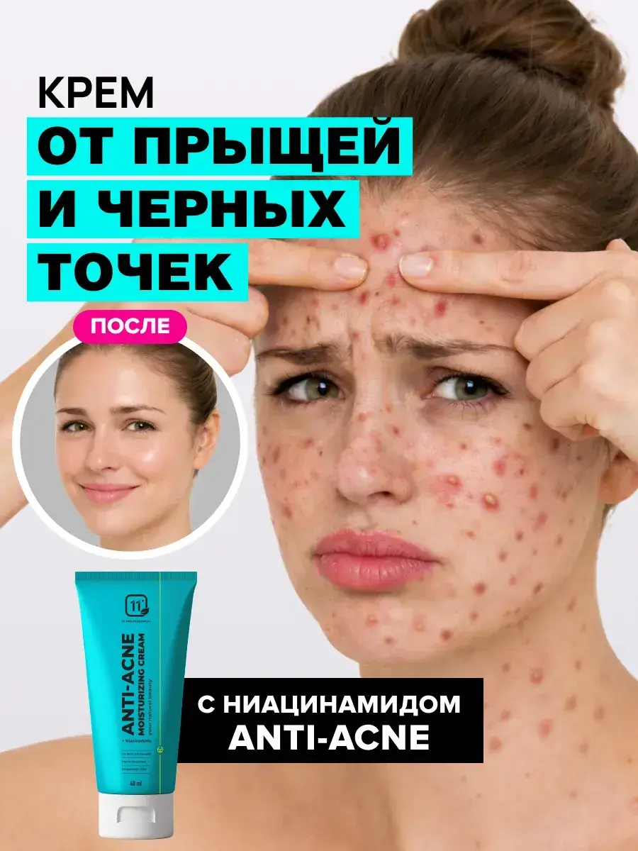 11i professional Face Cream with Niacinamide and Zinc 40 ml
