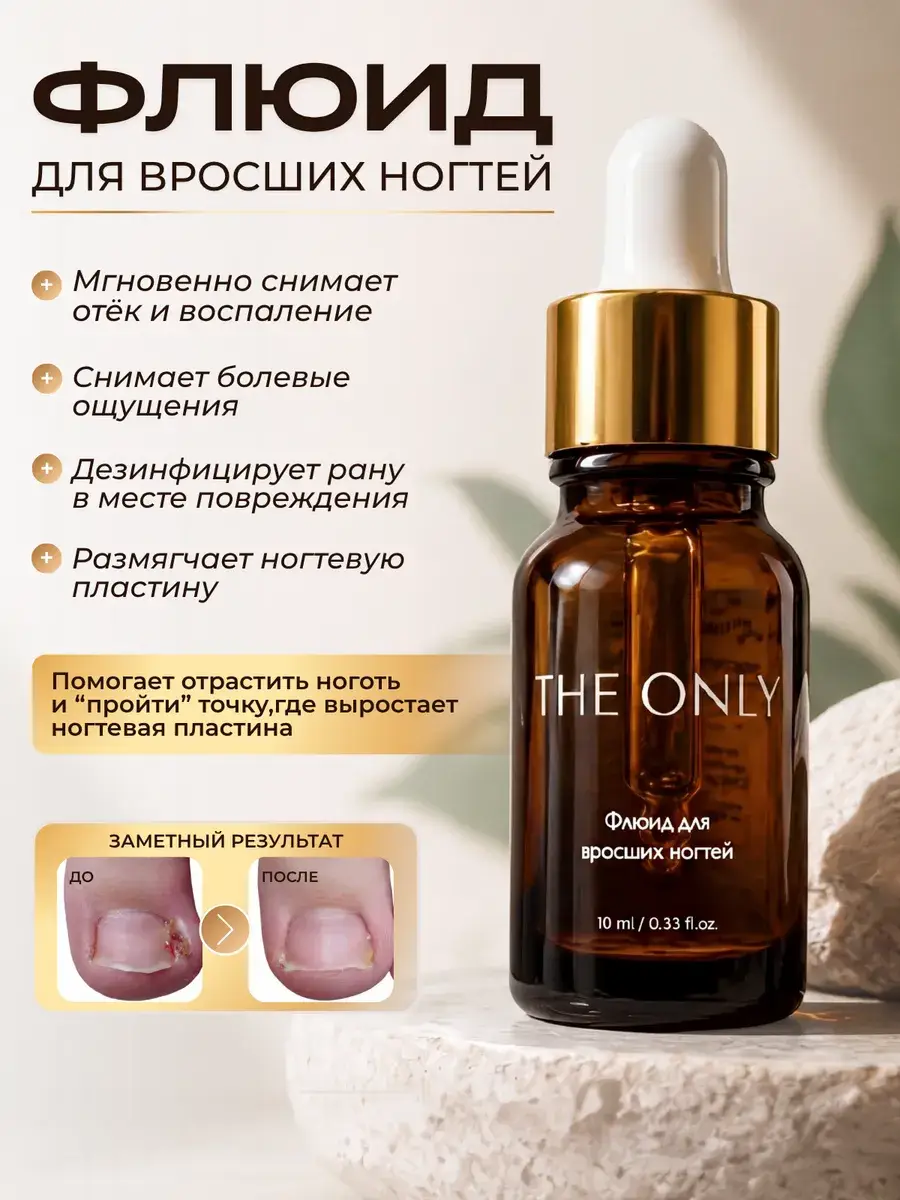 THE ONLY Ingrown Nail Care Fluid