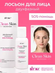 Vitex Clean Skin SOS Biphasic Zinc Lotion 50 ml #1