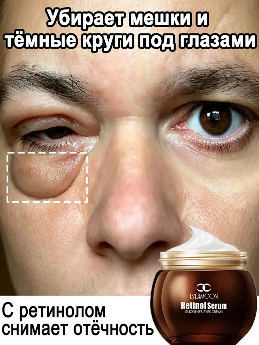 LYDIMOON Retinol Eye Cream 35 g