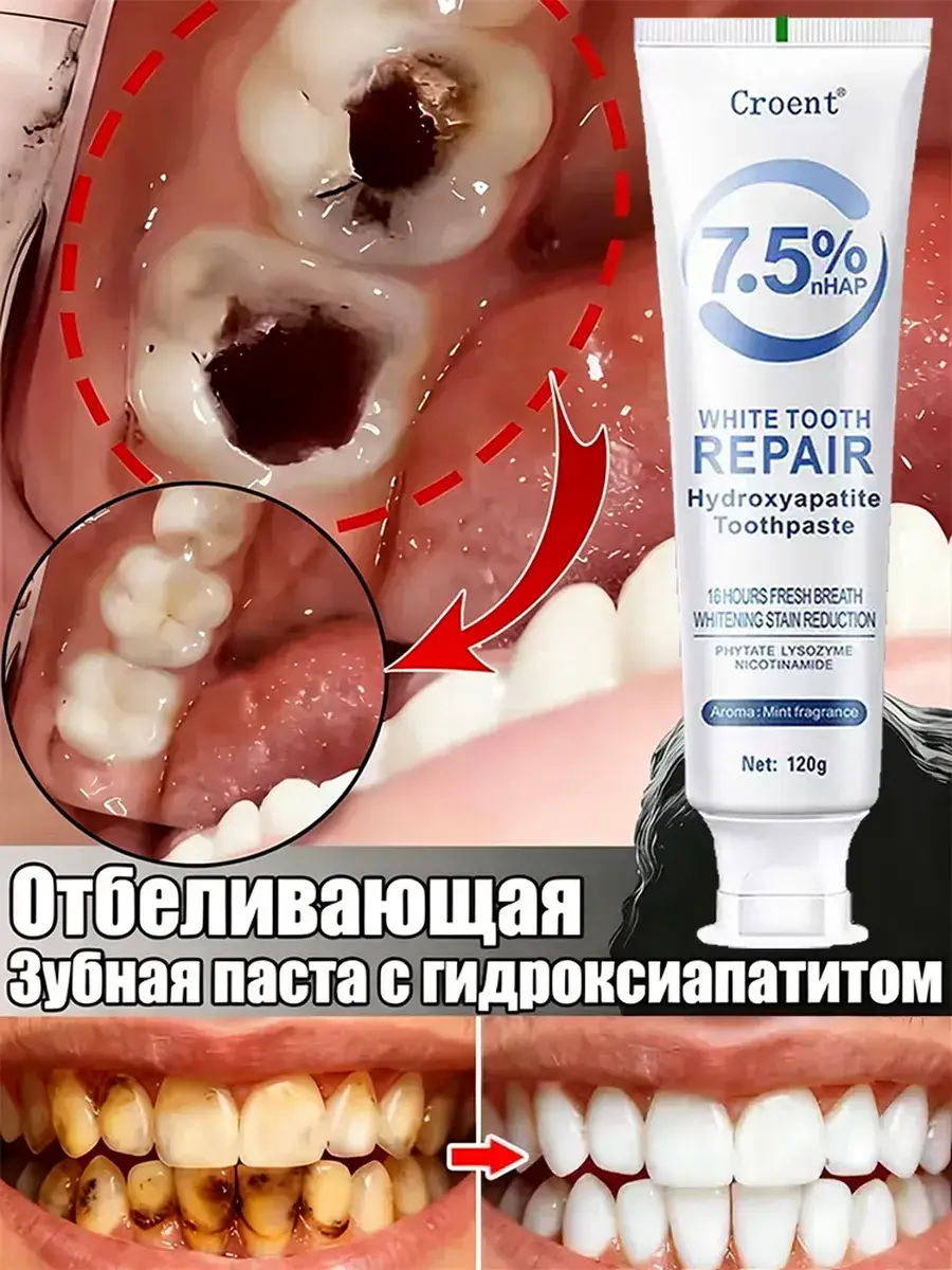 Croent Whitening Toothpaste with 7.5% Hydroxyapatite