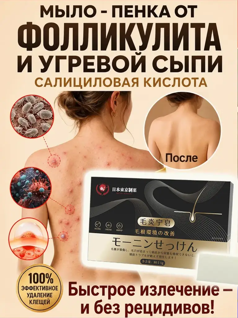 Acne Soap for Face and Body, 80 g #1