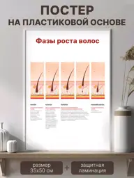Hair Growth Phases Medical Poster, 35 × 50 cm #1