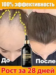 LYDIMOON Hair Growth Activator Oil #1