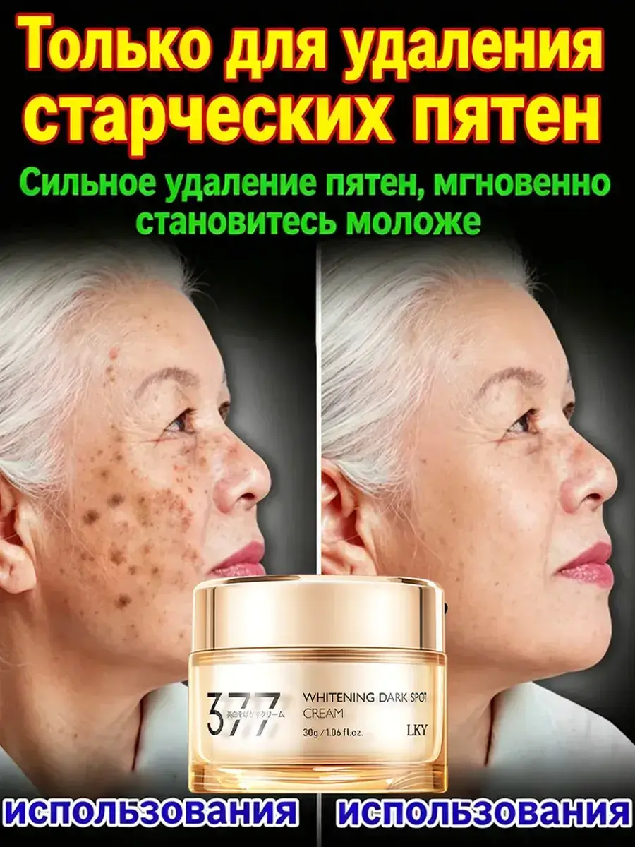 377 Brightening Face Cream for Pigmentation, 30 g