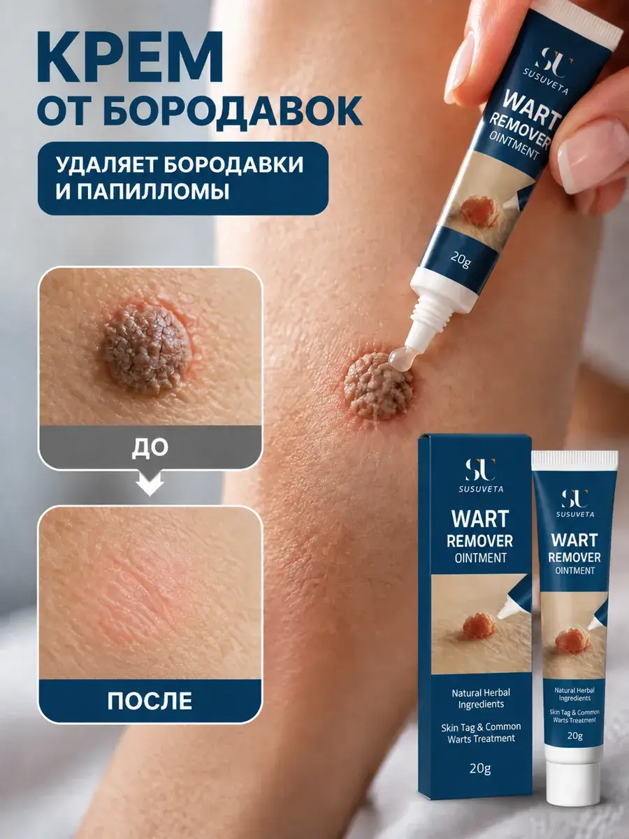 Skin Care Cream for Warts and Papillomas, 20 g