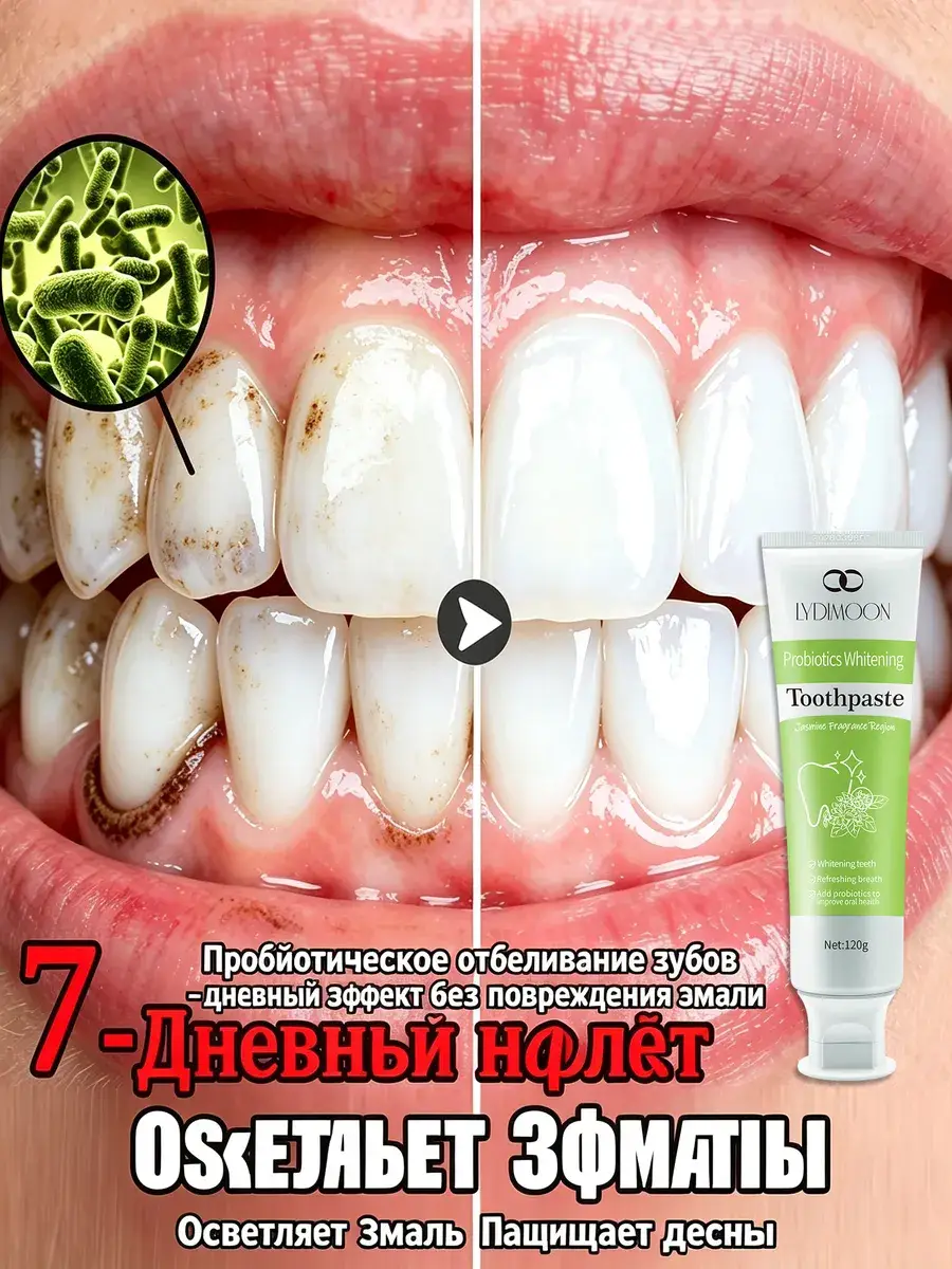 LYDIMOON Whitening Probiotic Toothpaste, 120 g