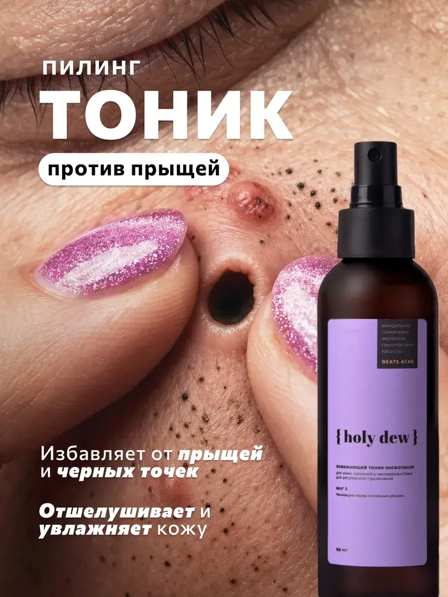 Holy Dew Face and Body Acne Toner 150 ml