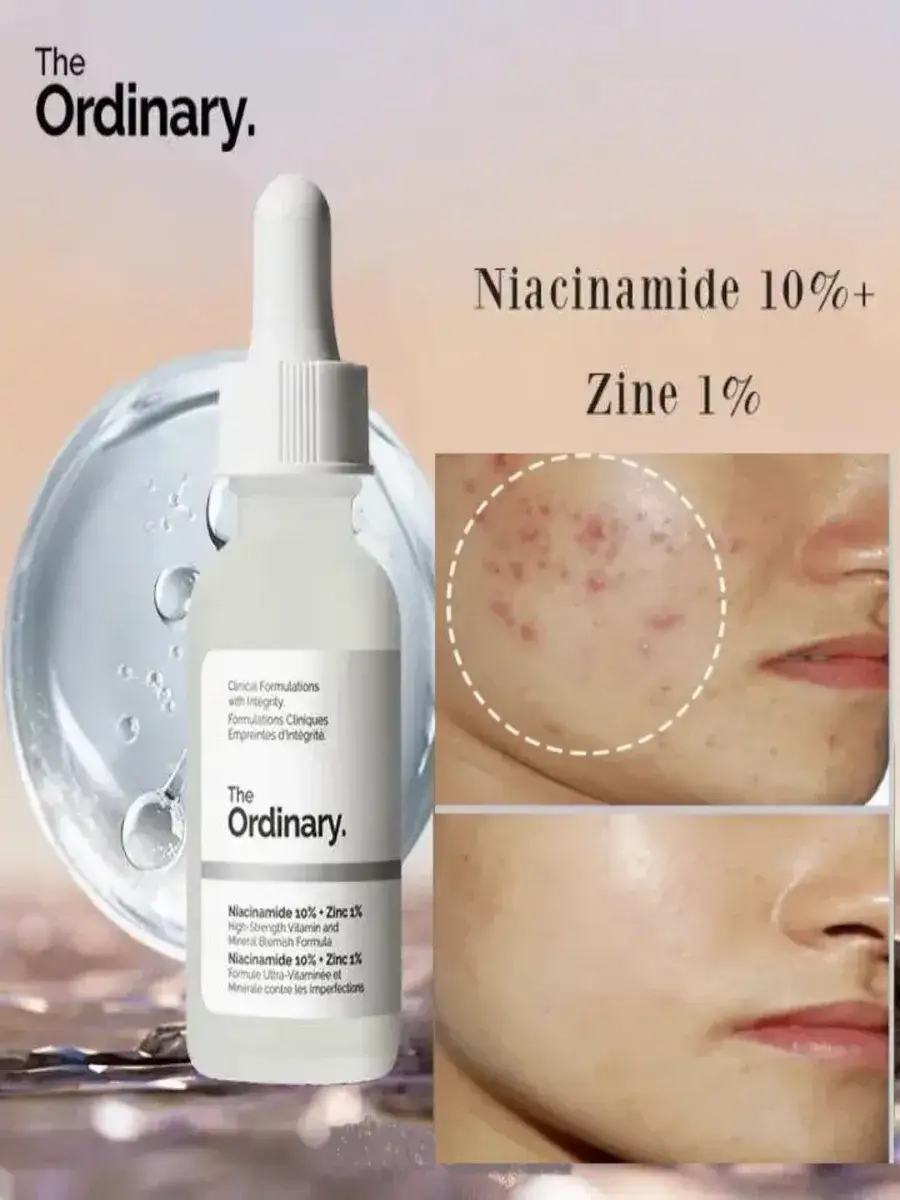 The Ordinary Niacinamide 10% + Zinc 1% Face Serum, 30 ml