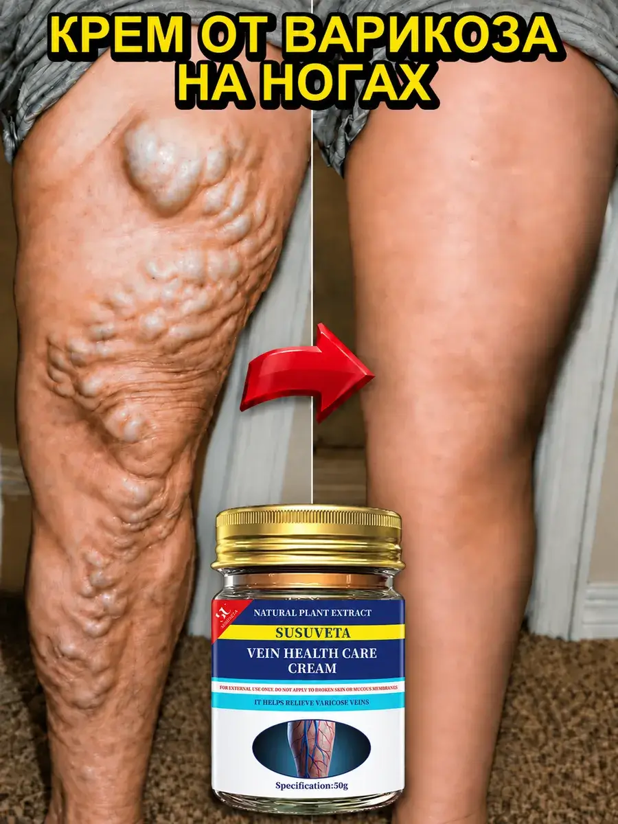 DODOYIRI Varicose Vein Leg Cream 50 ml