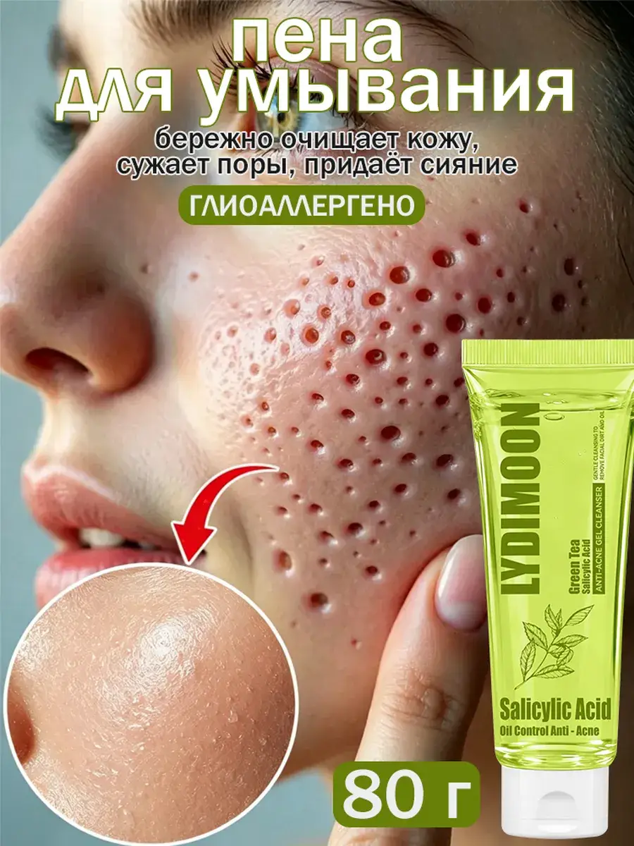 LYDIMOON Salicylic Acid Facial Cleansing Gel, 80 ml