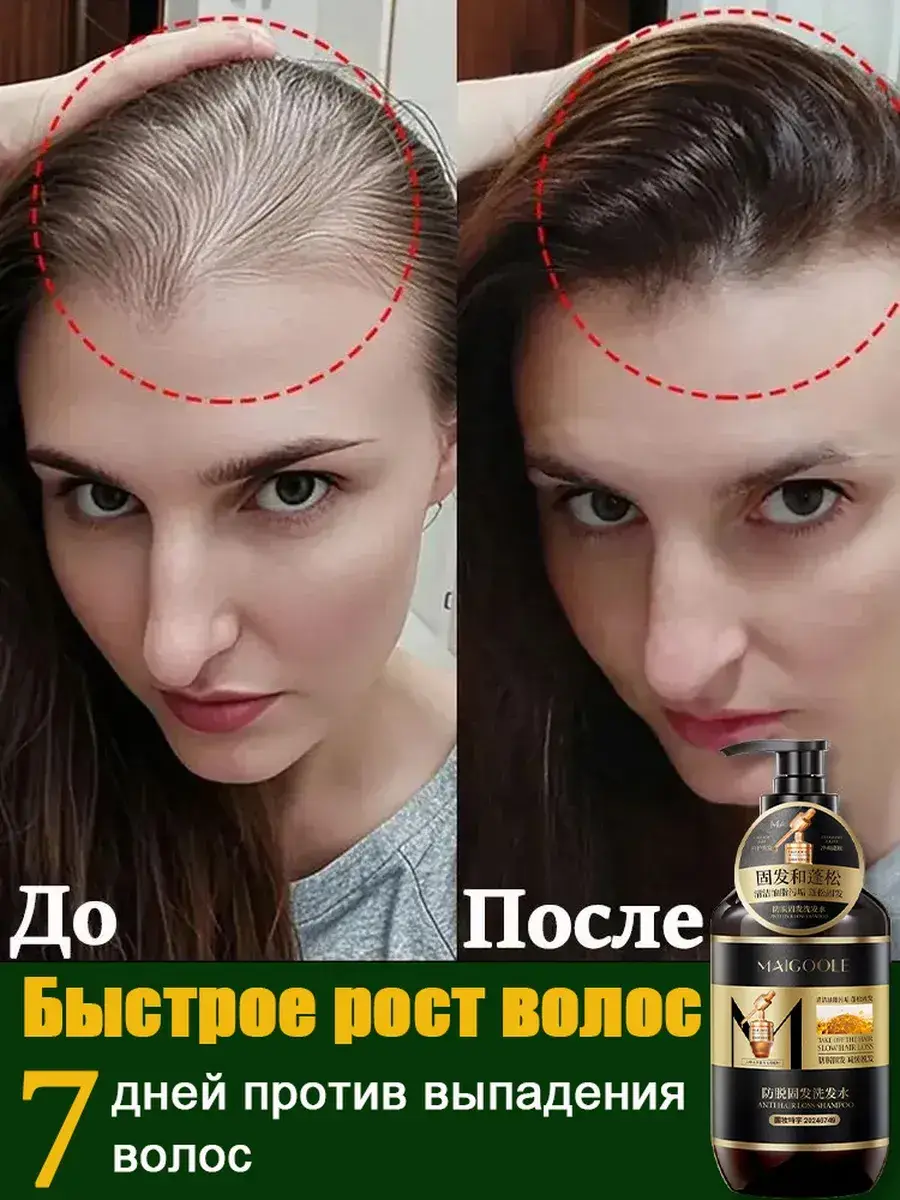 Anti-Hair Loss Shampoo for Growth, 400 ml