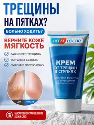 DO I POSLE Foot Cream for Cracks and Dry Skin 150 ml #1