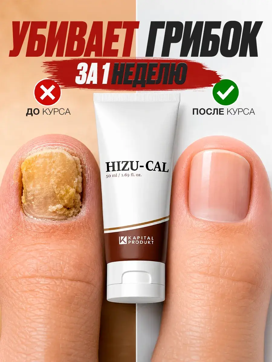 Kapital Produkt Hizu-Cal Antifungal Nail Ointment 50 ml