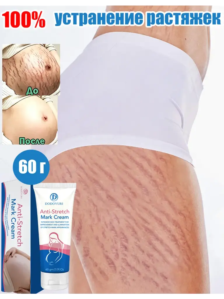 Stretch Mark Cream, 60 g #1