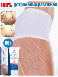 Stretch Mark Cream, 60 g #1