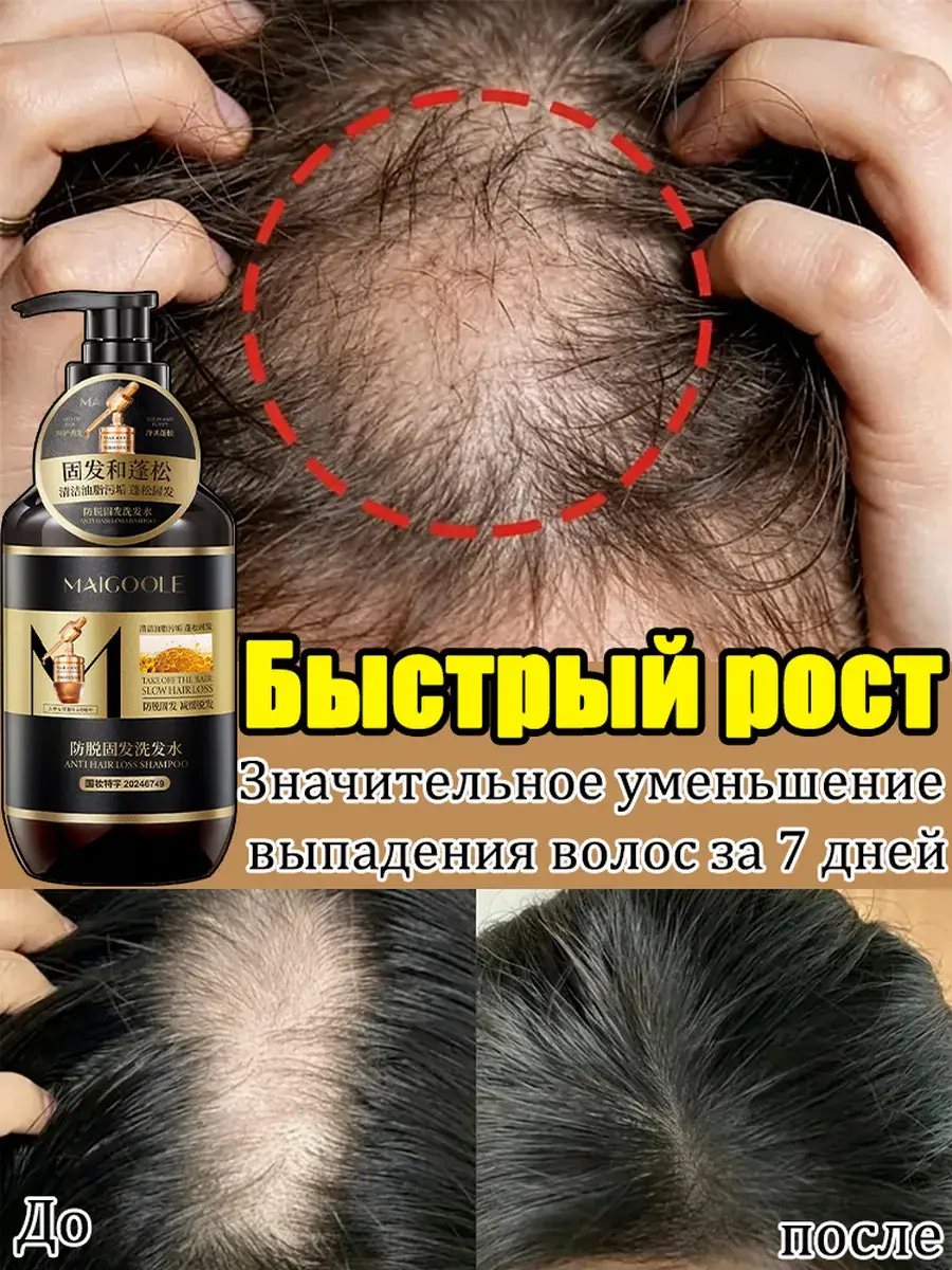 Meidailin Hair Shampoo, 400 ml