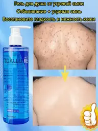 IUALLURE Whitening Back Acne Shower Gel 300 ml #1