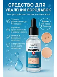 Sadeor Wart Removal Serum 30 ml #1
