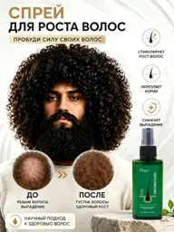 Hair Growth Spray Lotion 120 ml #1
