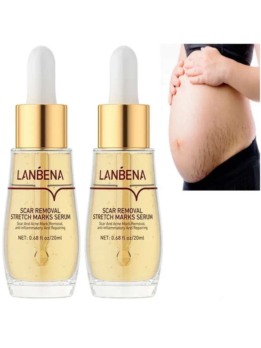 LANBENA Stretch Mark and Scar Serum 20 ml 2 Pack