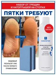 Nanopyatki Foot Keratolytic Solution 300 ml Set #1