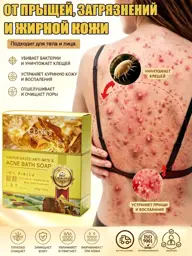 Sulfur Soap for Body, 100 g #1
