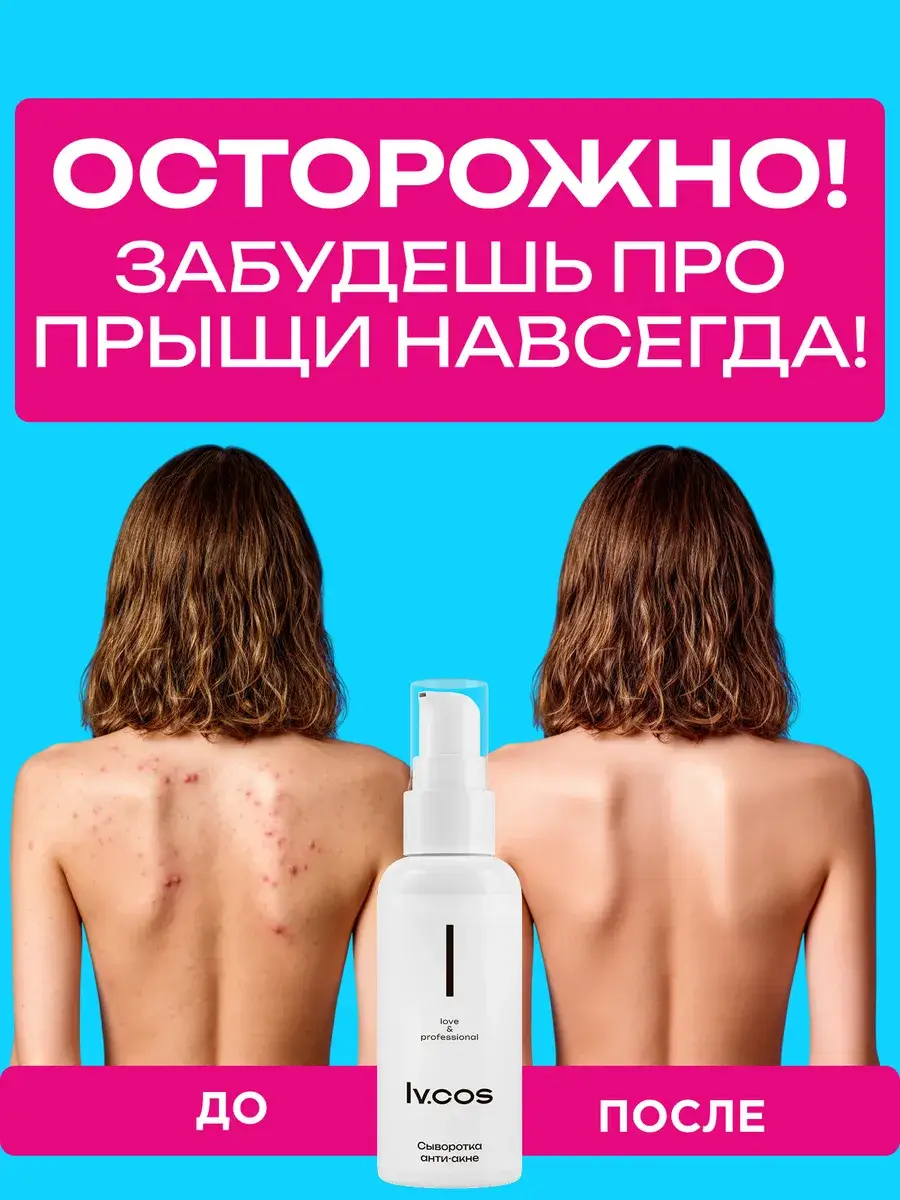 LV.COS Body Cream for Back Blemishes 50 ml