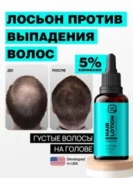 11i professional Hair and Beard Growth Lotion with Capixyl 5%, 30 ml #1