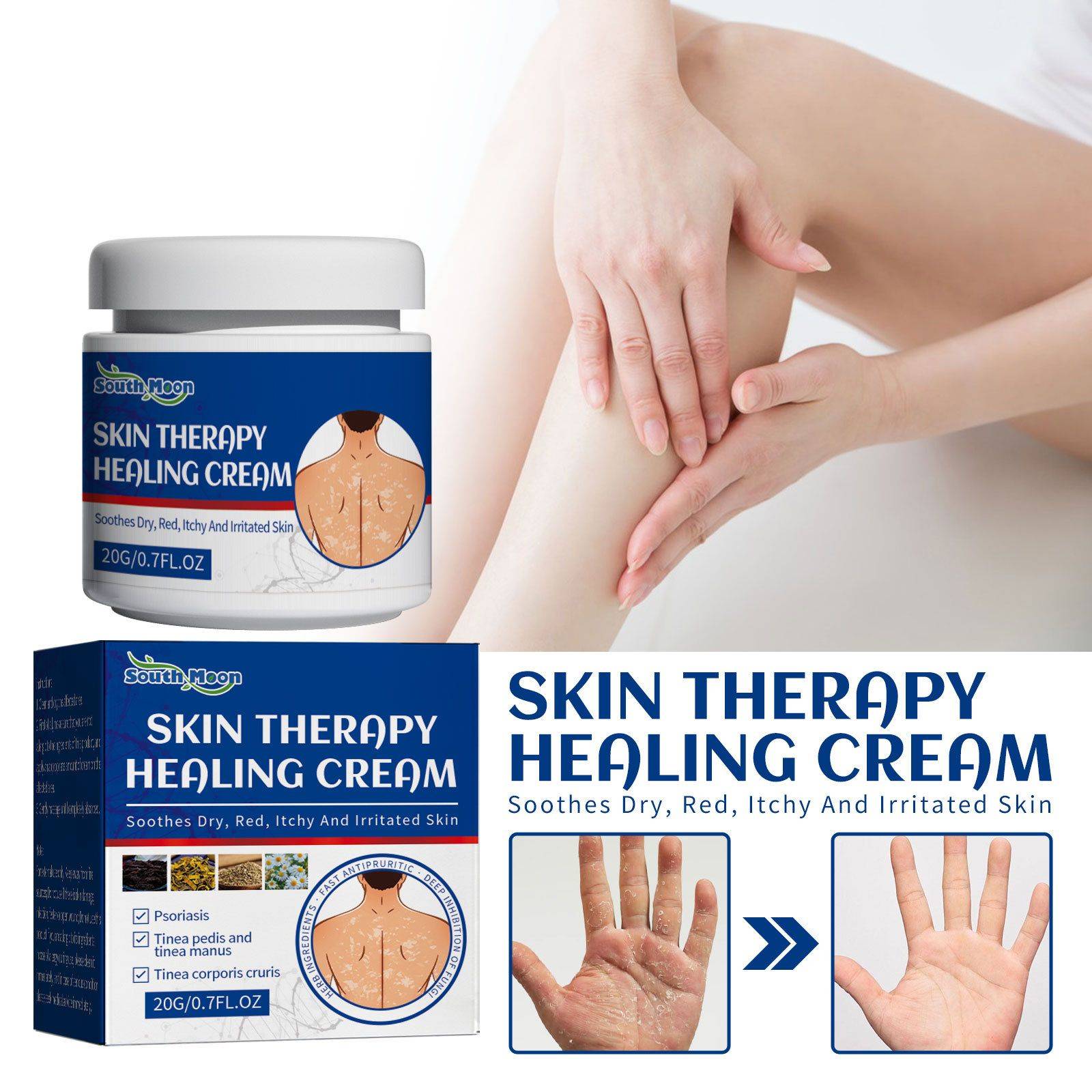 Topical Herbal Skin Care Cream 20g