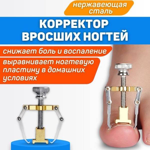 ORTGUT Stainless Steel Toe Corrector for Ingrown Toenail / Onychocryptosis Nail Plate Lifter - Adult, 1 Piece