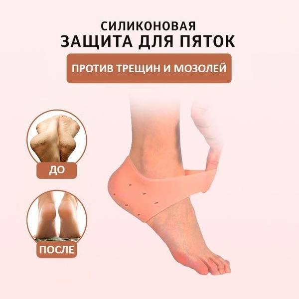 Silicone Heel Socks for Cracked Heels, Calluses, and Dry Skin: Foot Protection & Heel Spur Relief