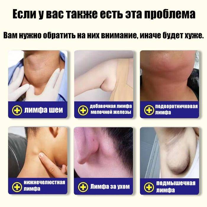Cream for Subcutaneous Swellings - 20ml, for Skin Edema, Cellulite, and Fibroadipose Tumors #4