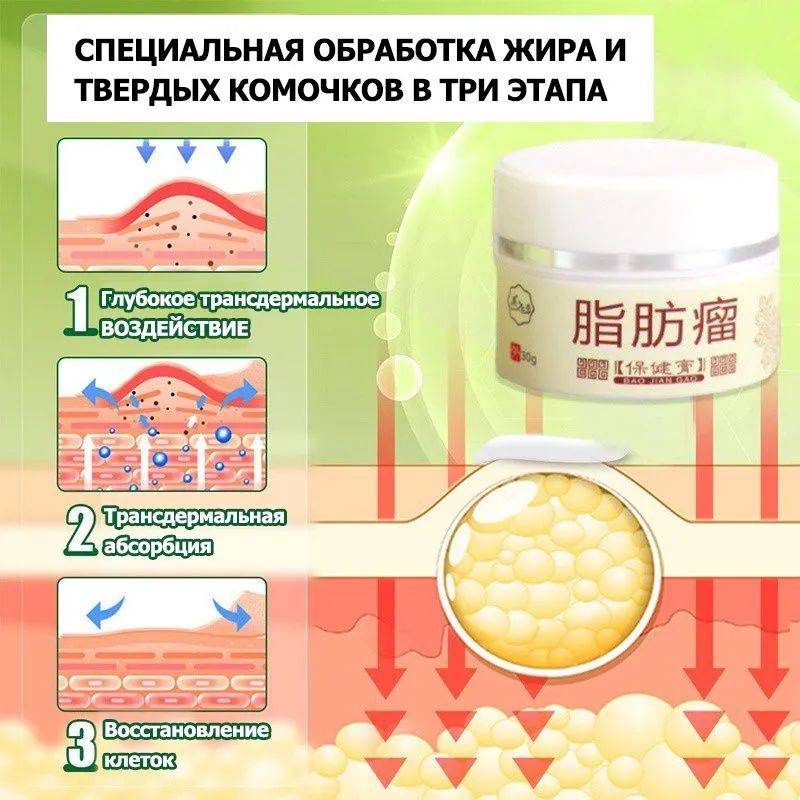 Cream for Subcutaneous Swellings - 20ml, for Skin Edema, Cellulite, and Fibroadipose Tumors #8