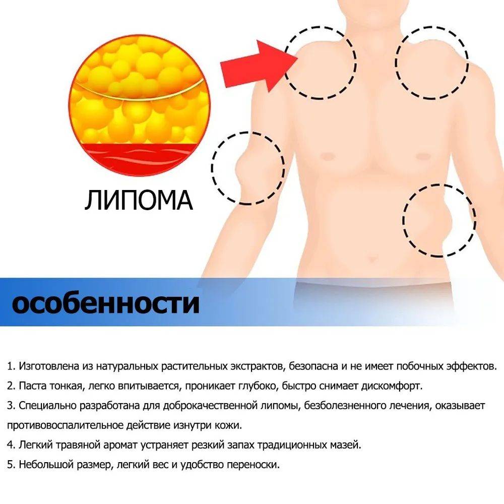 Cream for Subcutaneous Swellings - 20ml, for Skin Edema, Cellulite, and Fibroadipose Tumors #9