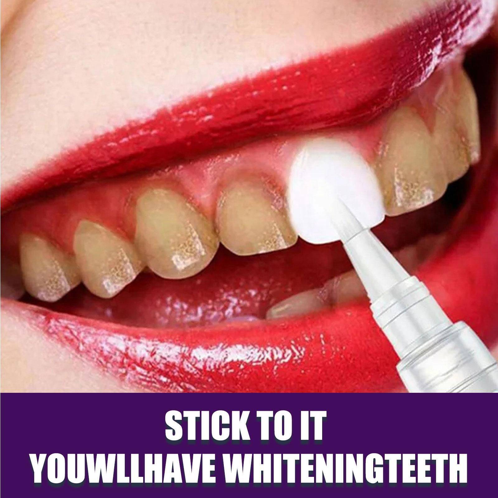 Whitening Pencil for Teeth – Anti‑Pigmentation Gel, 3 ml #10