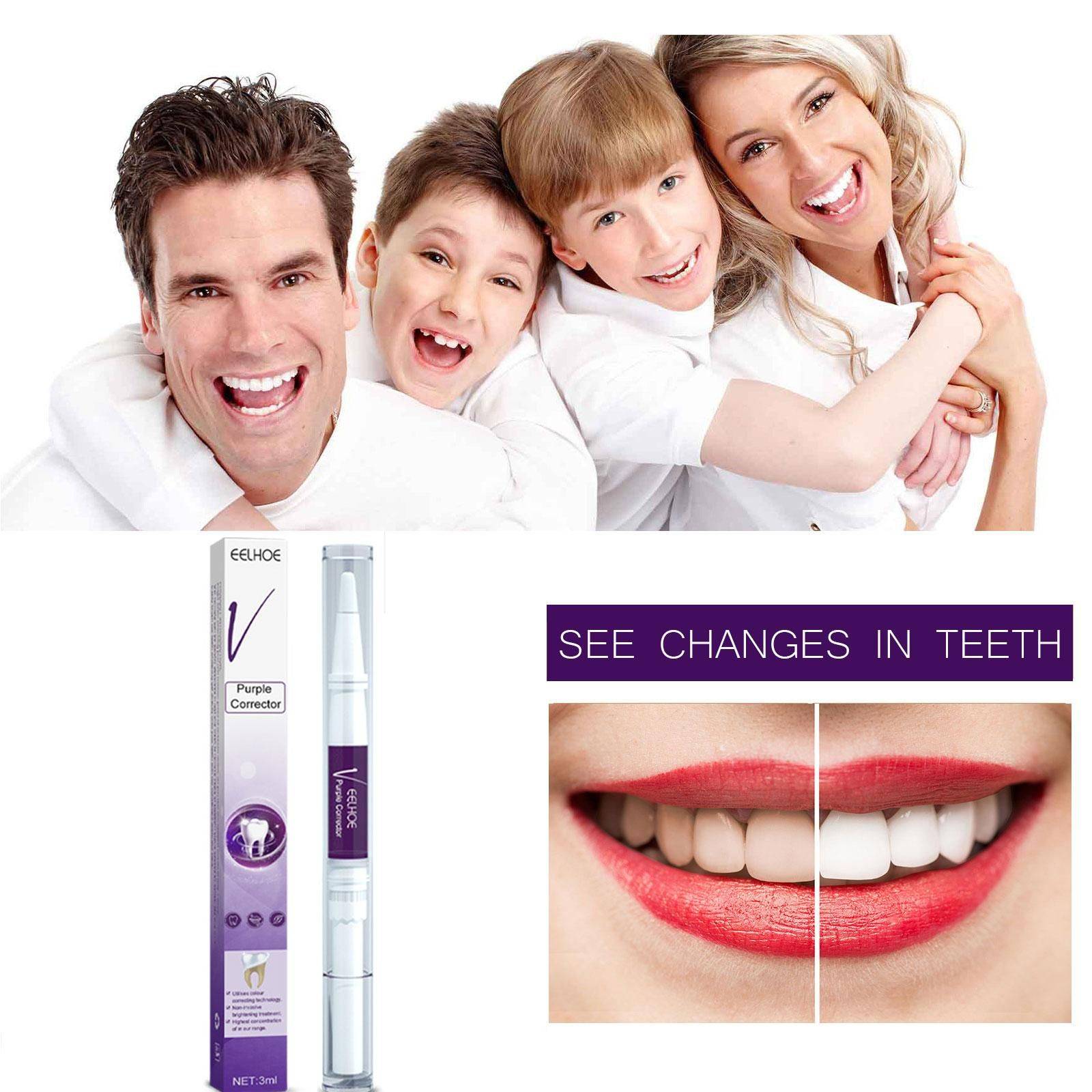 Whitening Pencil for Teeth – Anti‑Pigmentation Gel, 3 ml #5