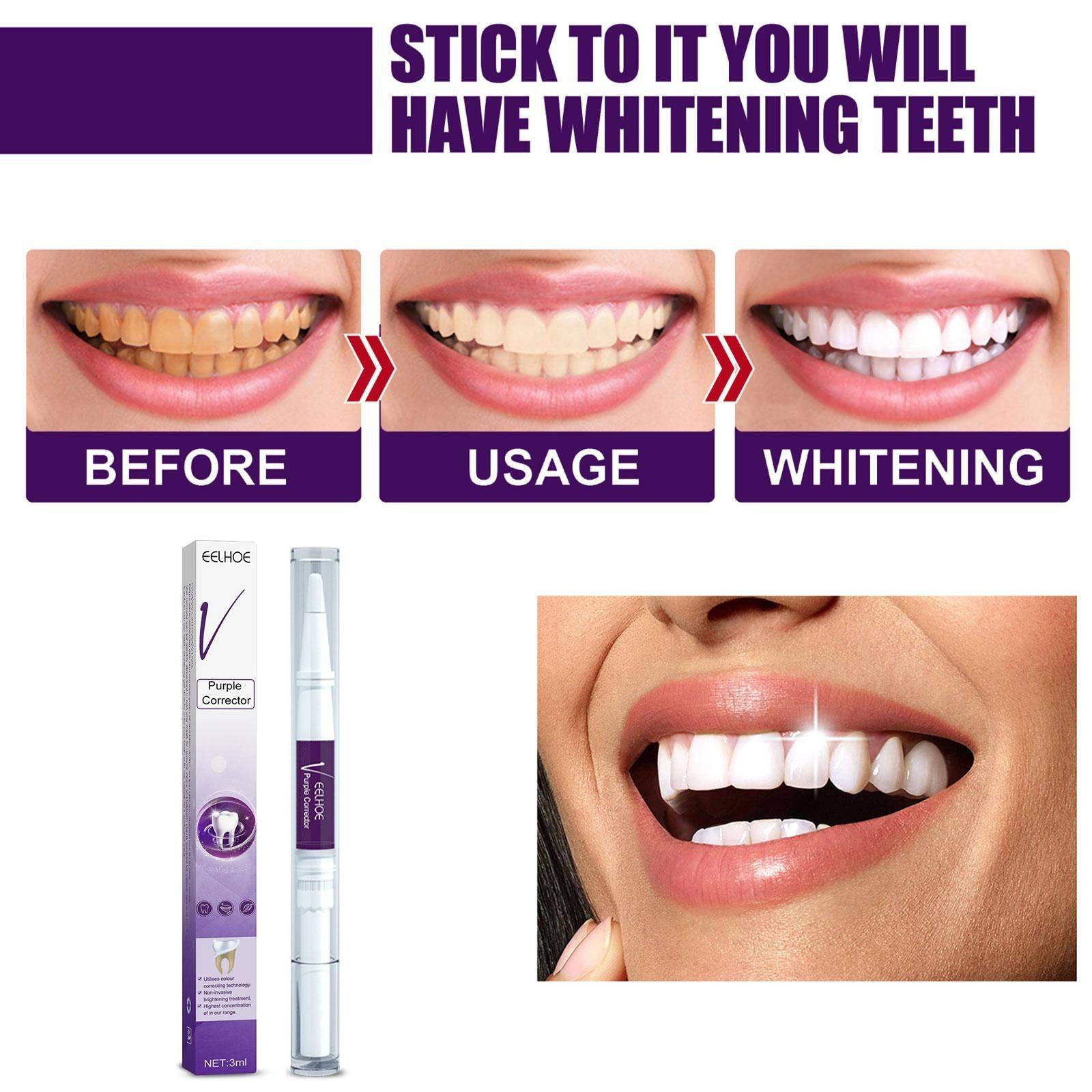 Whitening Pencil for Teeth – Anti‑Pigmentation Gel, 3 ml #7