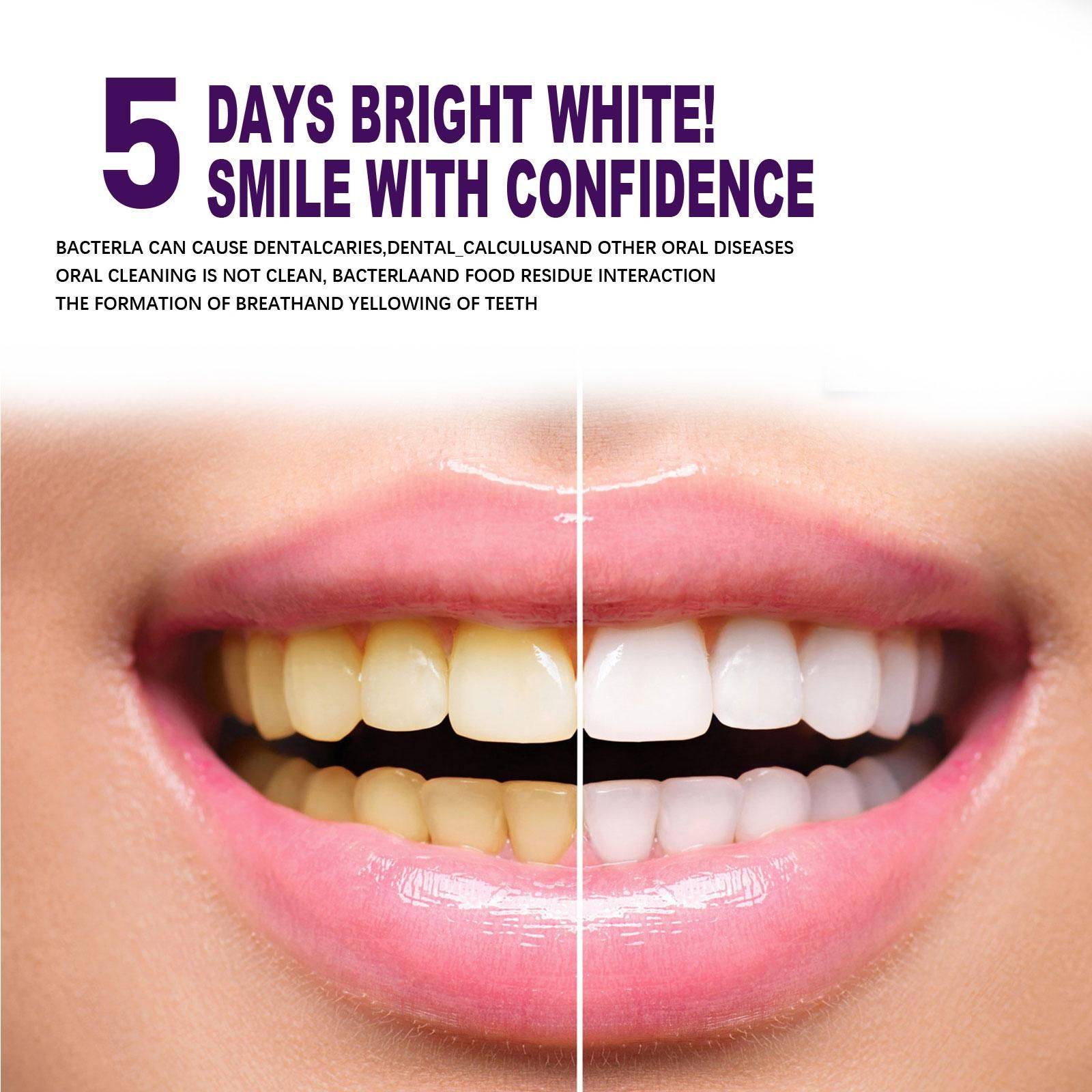 Whitening Pencil for Teeth – Anti‑Pigmentation Gel, 3 ml #12