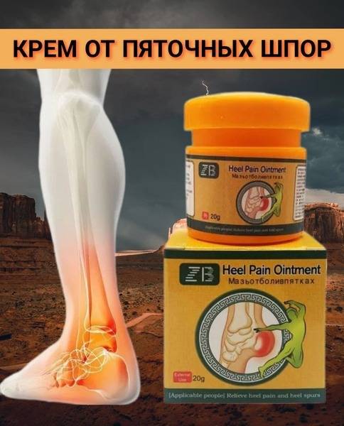 Bagira Heel Spur Relief Ointment Cream 20 g
