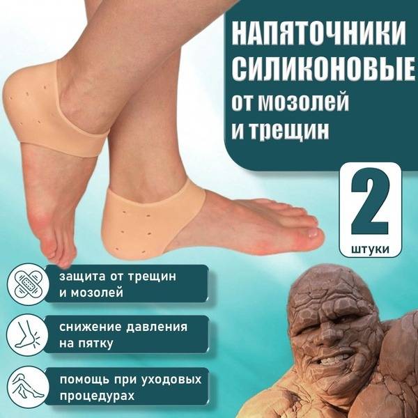 MeM Universal Silicone Heel Protectors for Cracked Heels, Corns, and Calluses, 2 Count