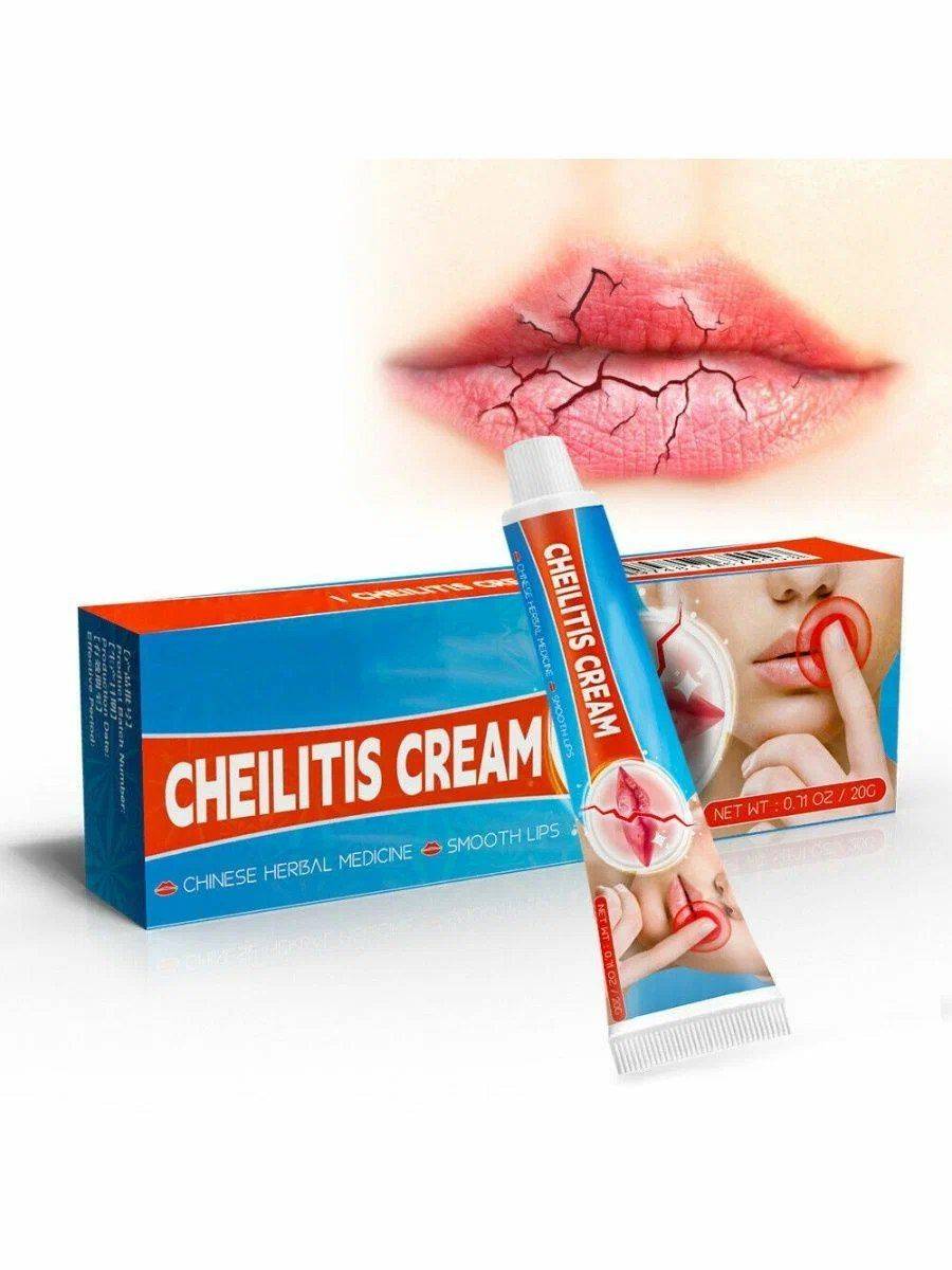 Sumifun Cheilitis Cream 20 mL — medicinal lip care for herpes and cheilitis #8