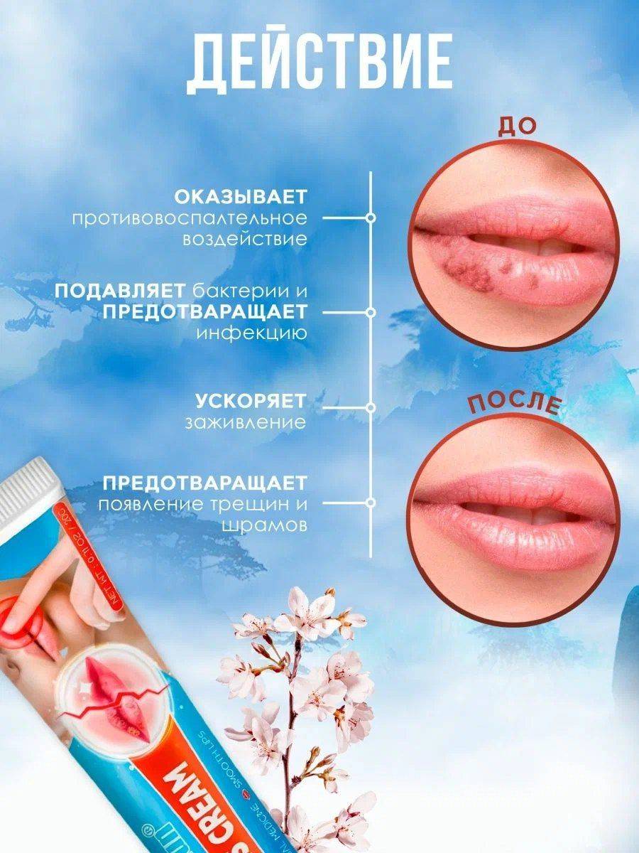 Sumifun Cheilitis Cream 20 mL — medicinal lip care for herpes and cheilitis #4