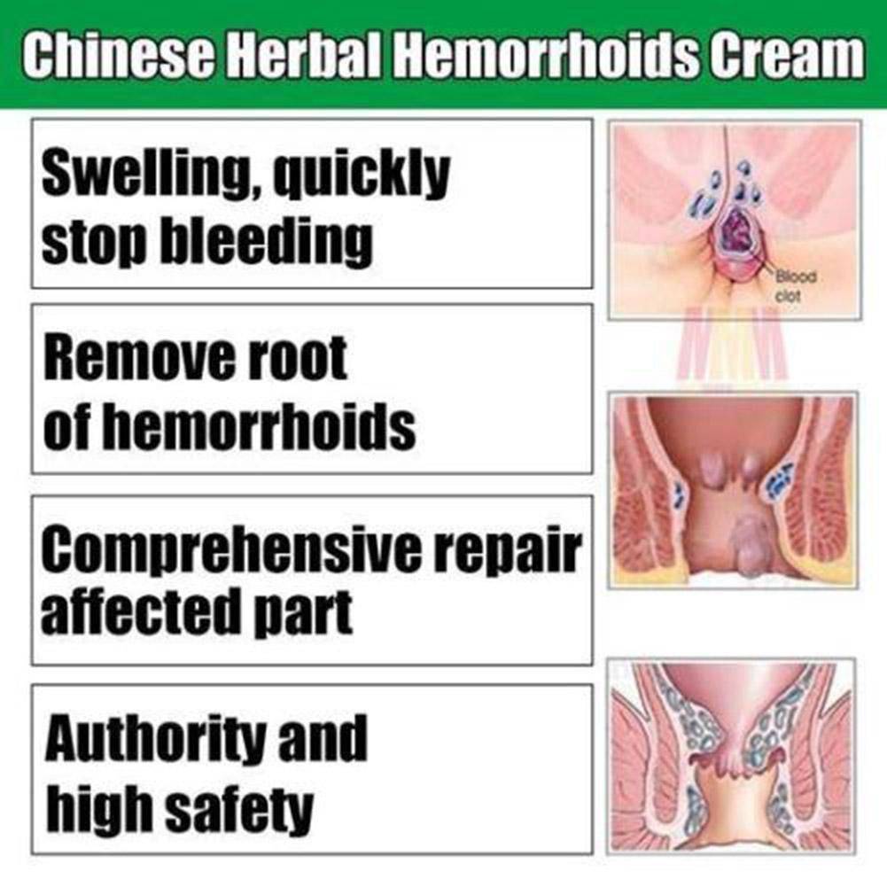 Hemorrhoid Balm and Anal Fissure Cream Gel, 3 Pack, 20 g Each #3