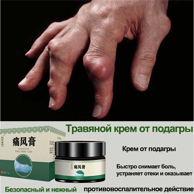 Gout Relief Joint Cream 105 g