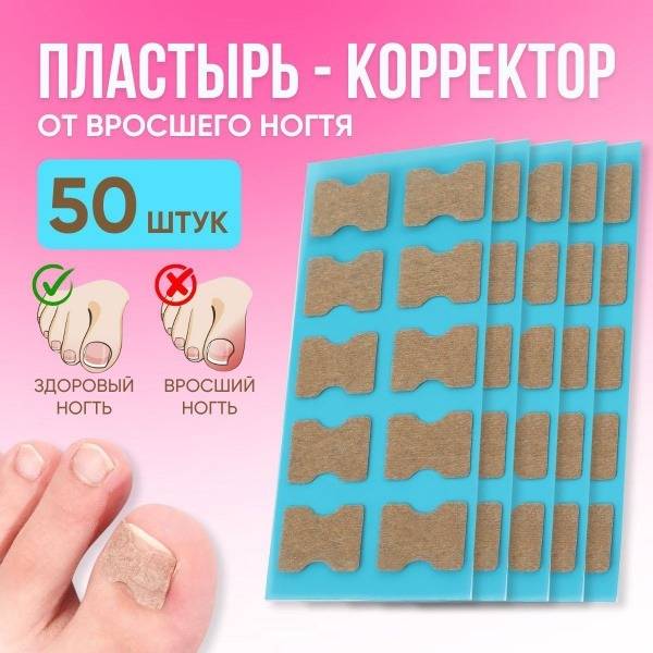 Toe Corrector Plaster for Ingrown Nail 50 pcs, Nail Plate Correction